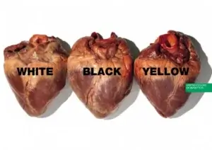 oliviero toscani